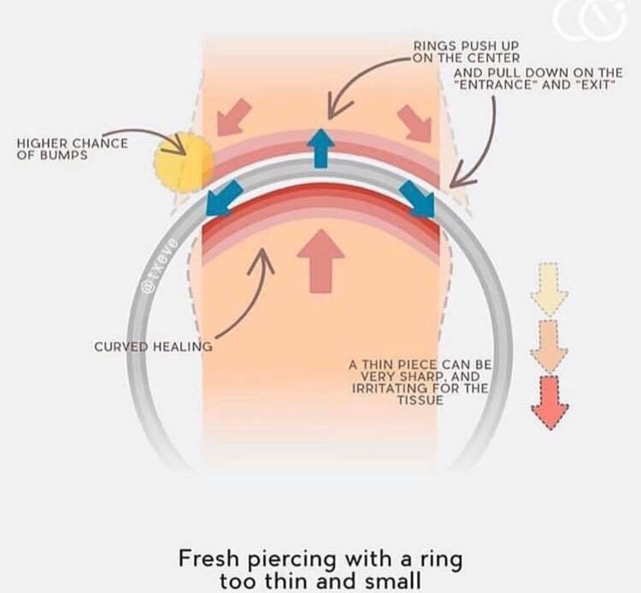 Bon à savoir avant de poser un anneau sur son helix - Kawaii Place piercing