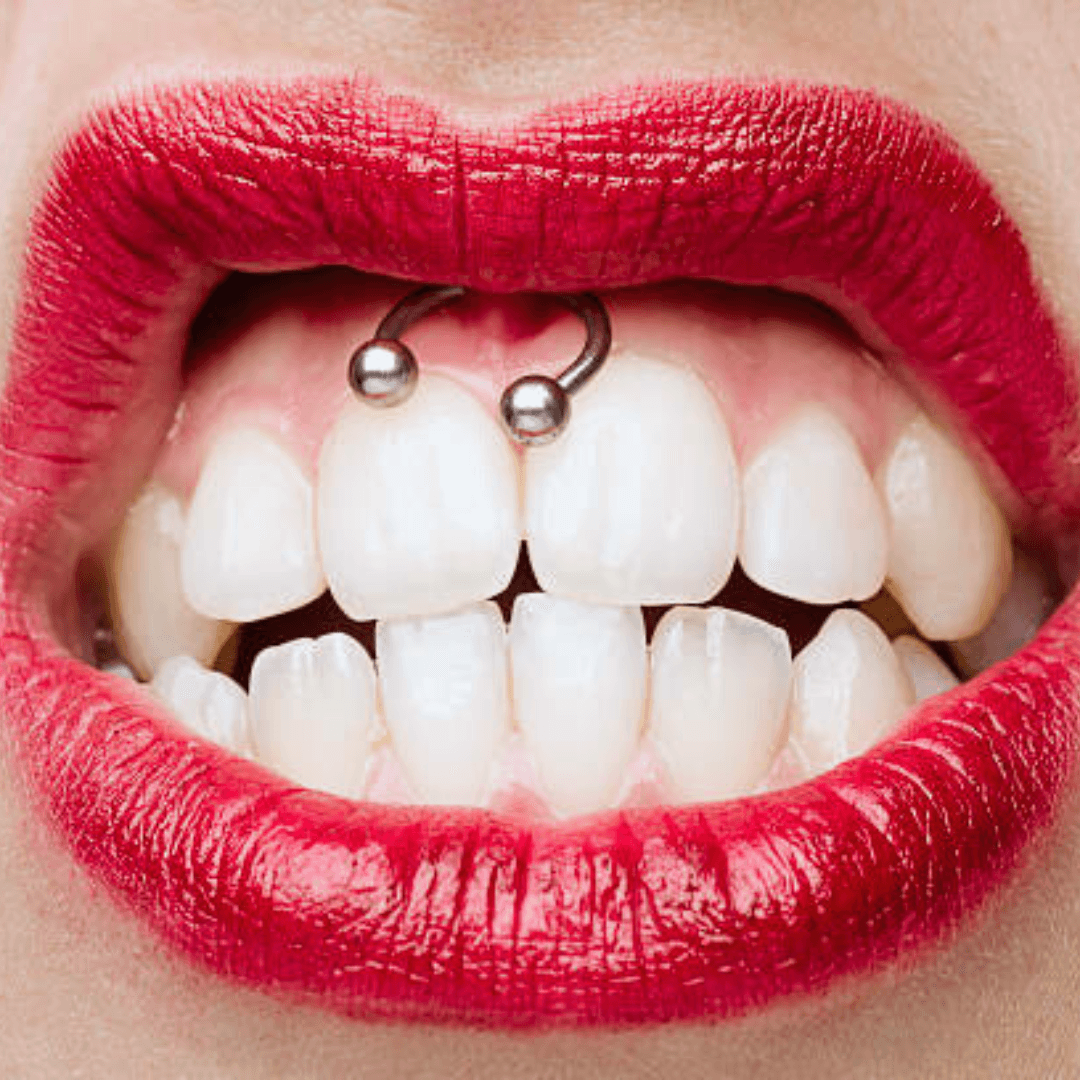 Quelques infos sur le piercing Smiley - Kawaii Place piercing 