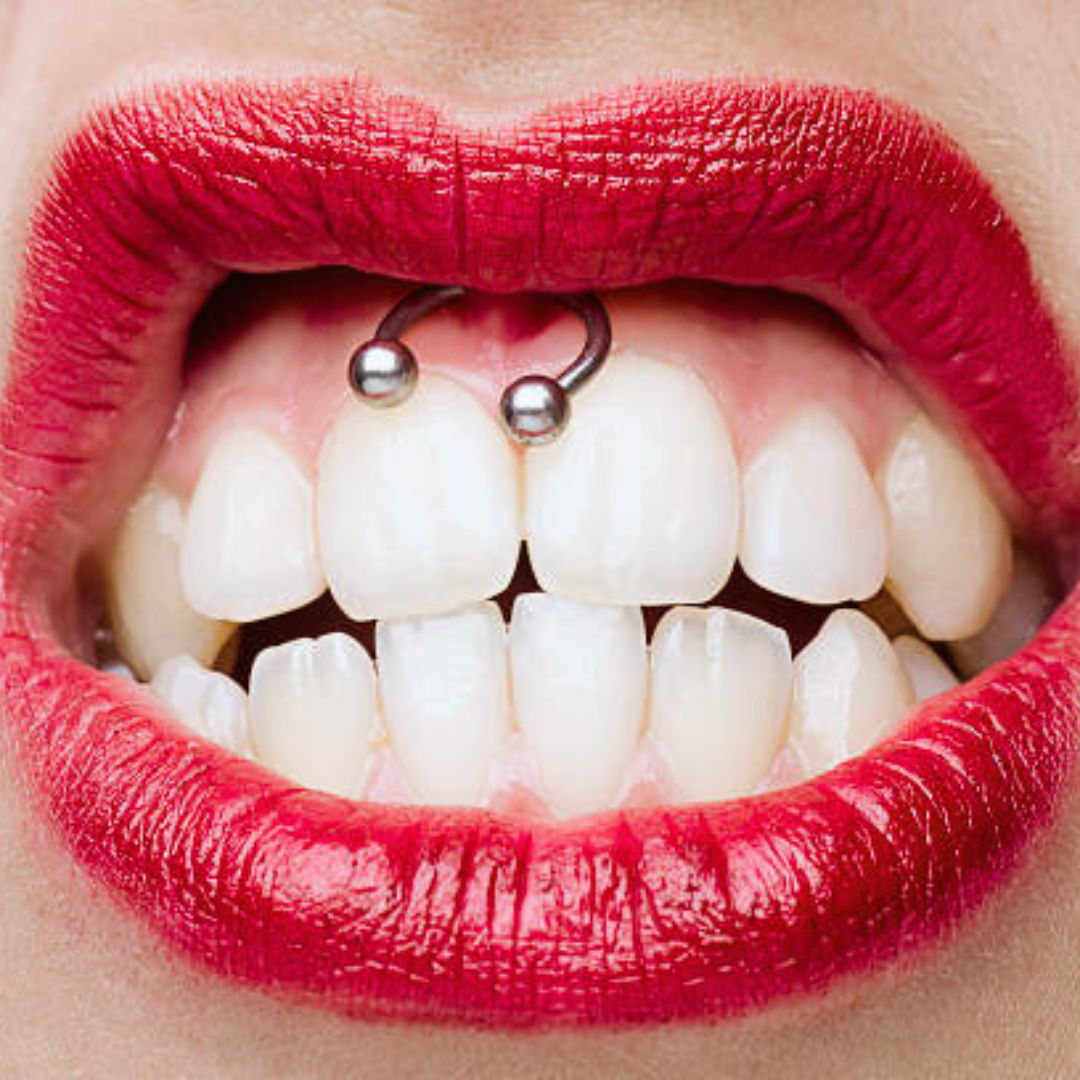 Quelques infos sur le piercing Smiley